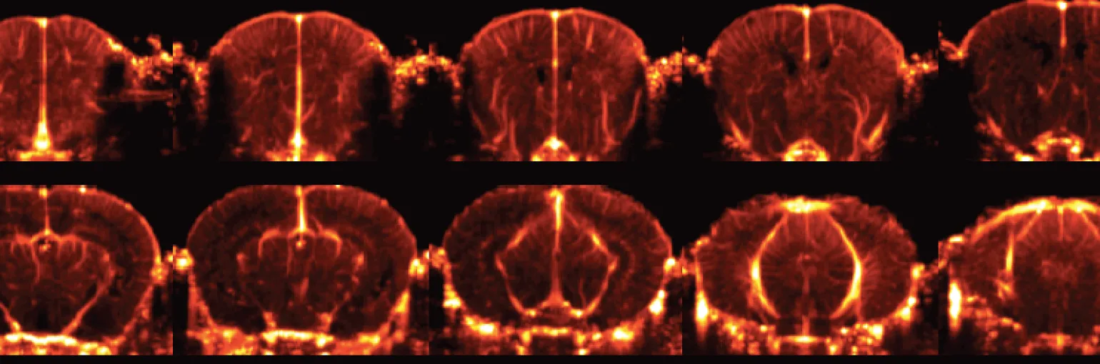 MG mouse brain vasculature atlas